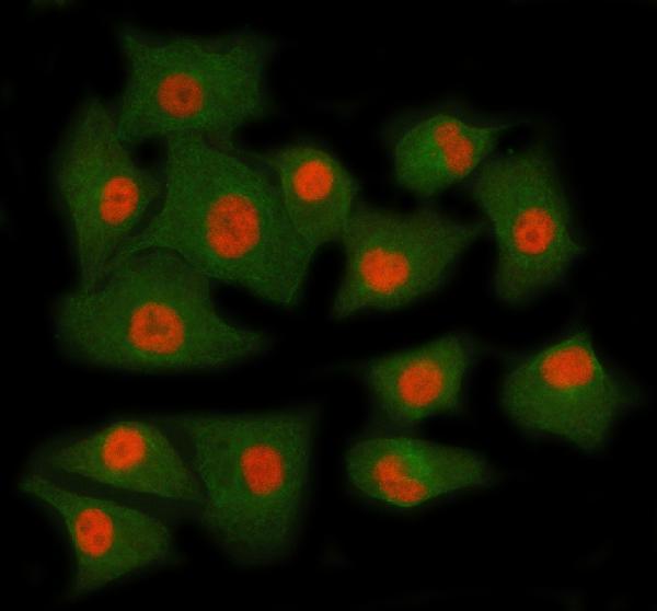 IF analysis of RING1 using anti-RING1 antibody (A01824-2) and anti-Beta Tubulin antibody (M01857-3)