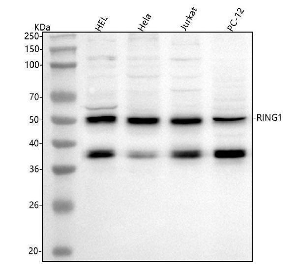  Western blot analysis of RING1 using anti-RING1 antibody (A01824-2)