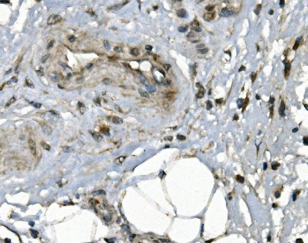  IHC analysis of JUNB using anti-JUNB antibody (A01825-2)
