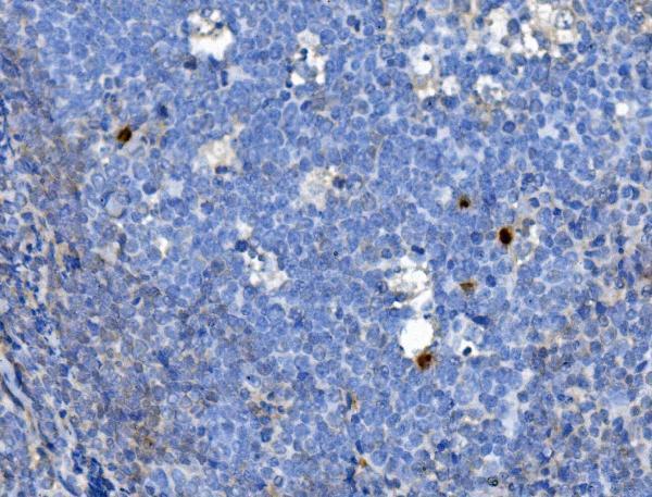  IHC analysis of JUNB using anti-JUNB antibody (A01825-2)