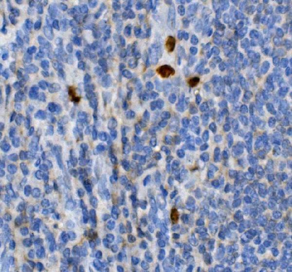 a01825 2 junb primary antibodies ihc testing 5