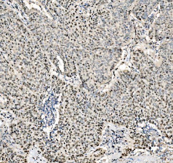  IHC analysis of JUNB using anti-JUNB antibody (A01825-3)
