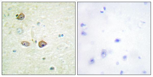 a01826 1 htr1b primary antibodies ihc testing 3