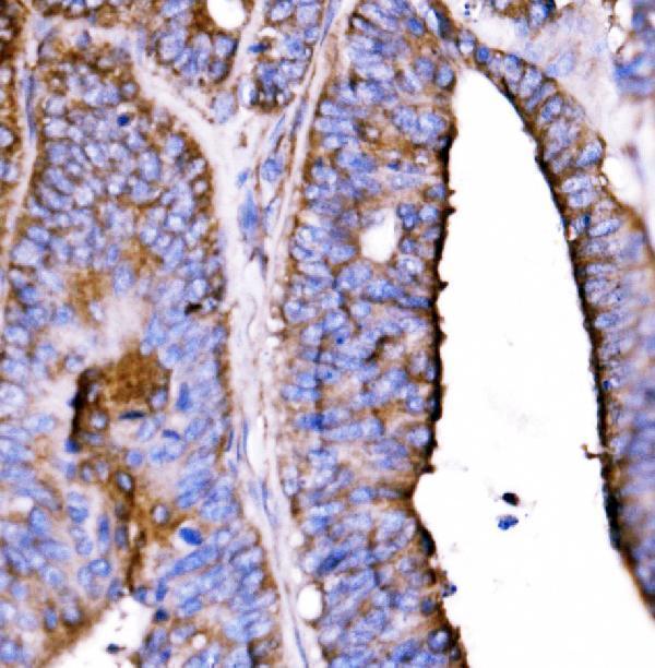  IHC analysis of 5HT1B/HTR1B using anti-5HT1B/HTR1B antibody (A01826-2)