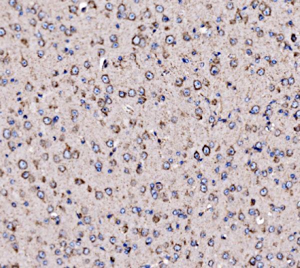 a01826 2 htr1b primary antibodies ihc testing 4