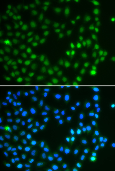 Immunofluorescence analysis of A549 cell using SALL4 antibody