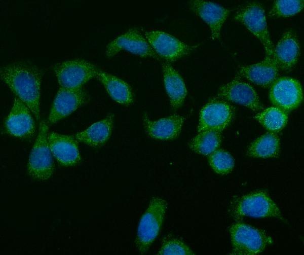 a01829 2 glb1 primary antibodies if testing 4