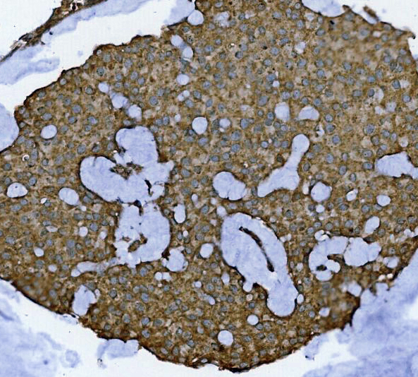 a01829 2 glb1 primary antibodies ihc testing 2_1