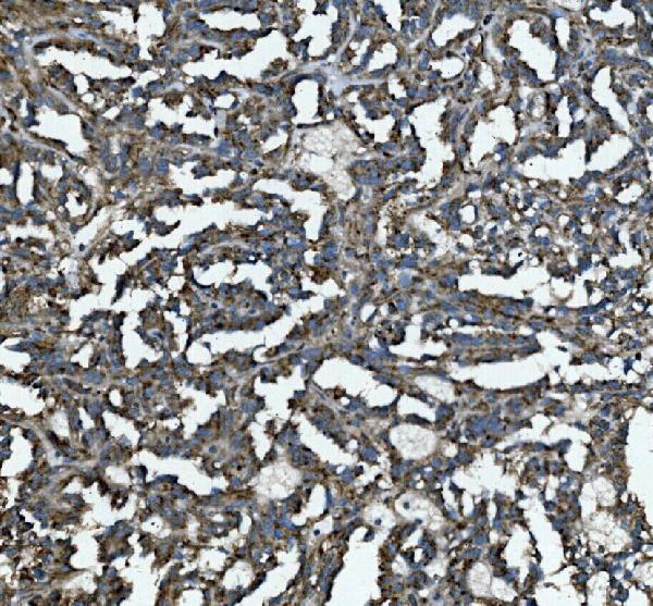 a01829 2 glb1 primary antibodies ihc testing 3_1