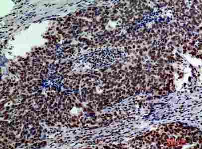 a01829 glb1 primary antibodyes ihc testing 1