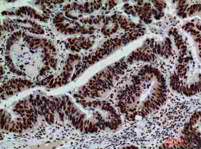 a01829 glb1 primary antibodyes ihc testing 3