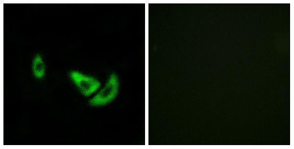 Immunofluorescence analysis of A549 cells, using DCT Antibody