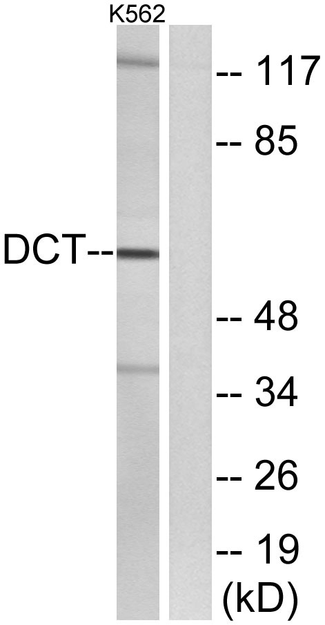 Western blot analysis of lysates from K562 cells, using DCT Antibody