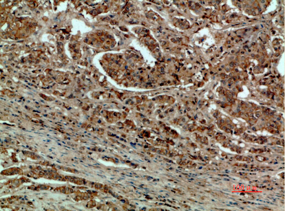 a01830 2 dct primary antibodyes ihc testing 2