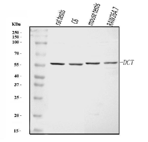  Western blot analysis of TRP2/DCT using anti-TRP2/DCT antibody (A01830-3)