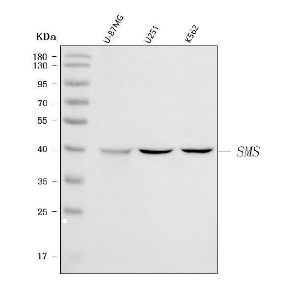  Western blot analysis of Spermine Synthase/SMS using anti-Spermine Synthase/SMS antibody (A01831-1)
