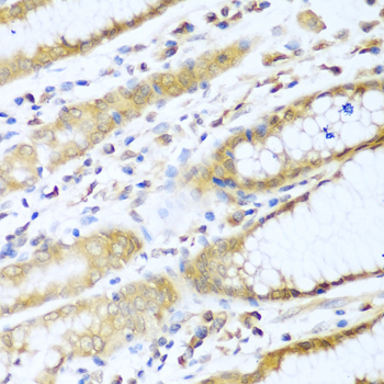 a01832 ube2l3 primary antiboties ihc testing 2