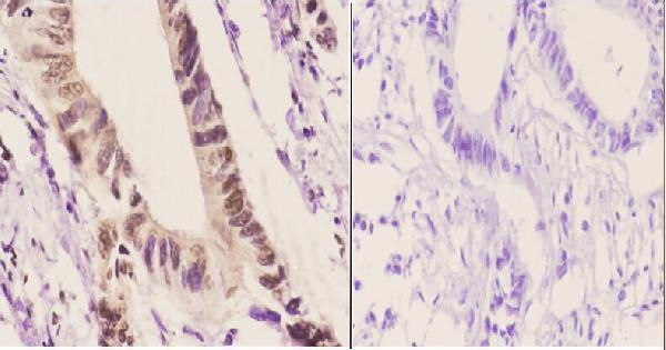 a01835 per3 primary antiboties ihc testing 2