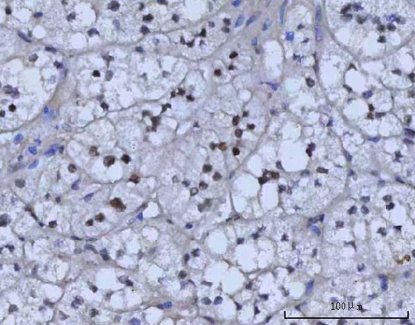 a01837 1 rad51c primary antibodies ihc testing 2