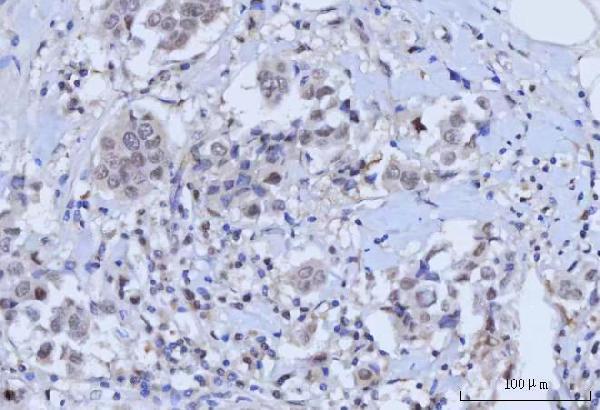 a01837 1 rad51c primary antibodies ihc testing 3