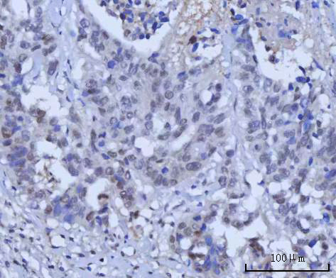 a01837 1 rad51c primary antibodies ihc testing 4