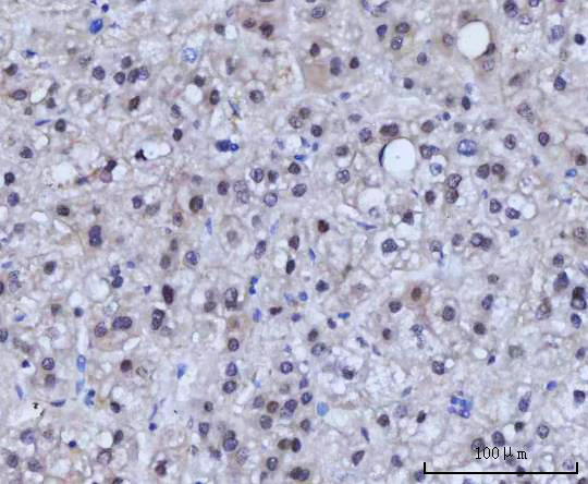 a01837 1 rad51c primary antibodies ihc testing 5