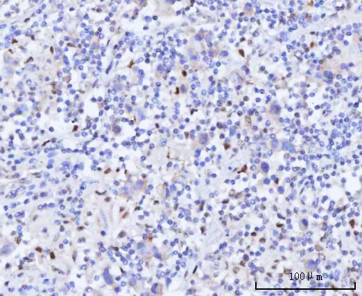 a01837 1 rad51c primary antibodies ihc testing 6