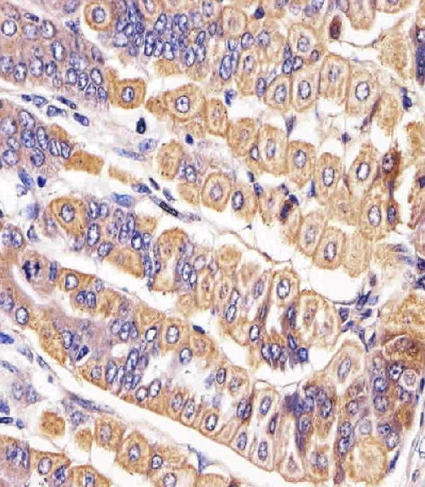 a01840 1 anti mouse ror2 antibody c term ihc p testing 2