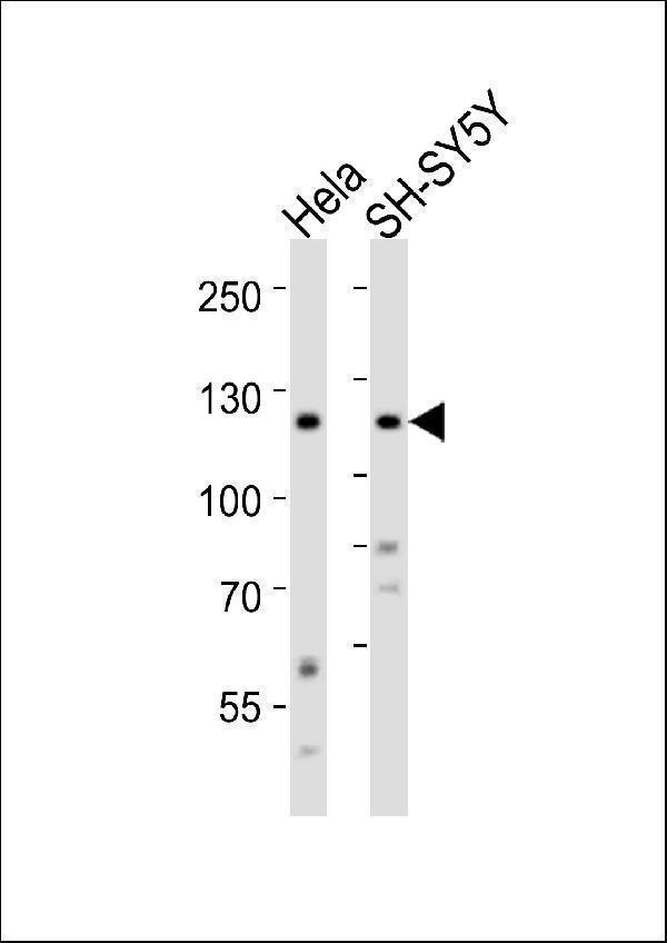 a01840 1 anti mouse ror2 antibody c term wb testing 1
