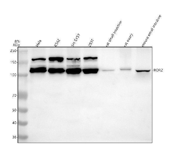 a01840 2 ror2 primary antibodies wb testing 1