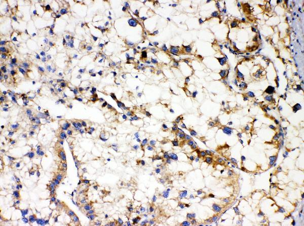 a01841 1 apol1 primary antibodies ihc testing 2