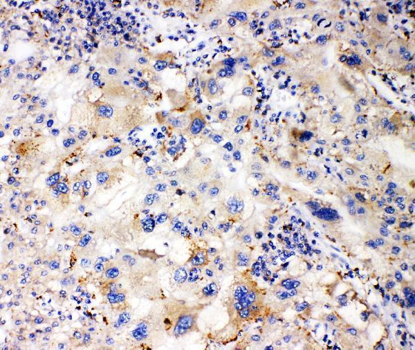 a01841 1 apol1 primary antibodies ihc testing 3