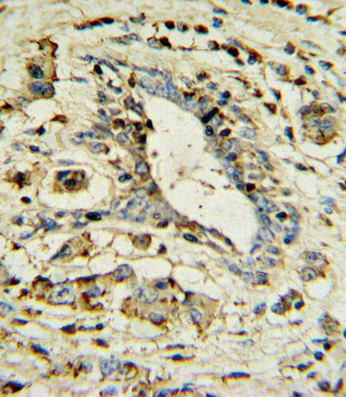 a01841 2 anti apol1 antibody ihc p testing 2
