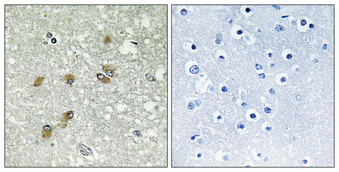 Immunohistochemistry validation of APOL1 using Anti-Apolipoprotein L1 ApoL1 Antibody (A01841)