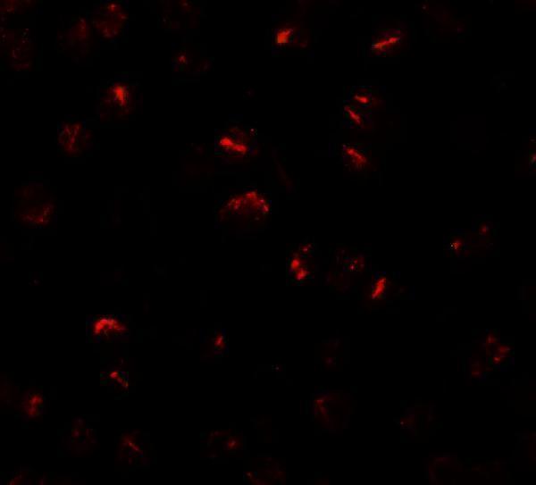 Immunofluorescence of BMP15 in 3T3 cells with BMP15 antibody at 20 μg/mL
