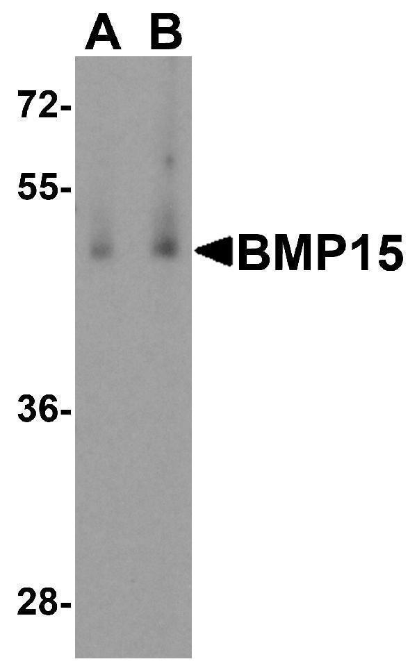 Western blot analysis of BMP15 in human testis tissue lysate with BMP15 antibody at (A) 1 and (B) 2 μg/mL
