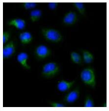 Immunofluorescent analysis of BMP15 staining in MCF7 cells