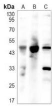 Western blot analysis of BMP15 expression in HCT116 (A), mouse heart (B), rat heart (C) whole cell lysates