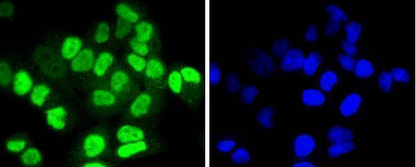 ICC staining HDAC8 in Hela cells (green)