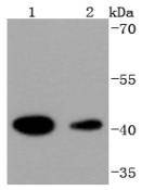 Western blot analysis of HDAC8 on different lysates using anti-HDAC8 antibody at 1/1,000 dilution