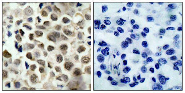 a01843s39 1 hdac8 primary antibodies ihc testing 1