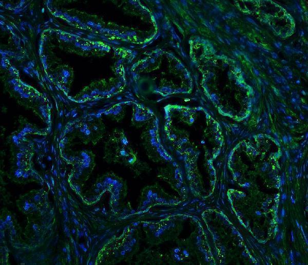 a01844 2 rtn4 primary antibodies if testing 3