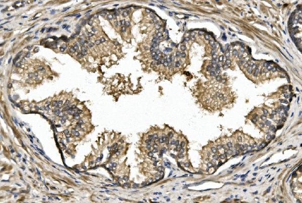 a01844 2 rtn4 primary antibodies ihc testing 2
