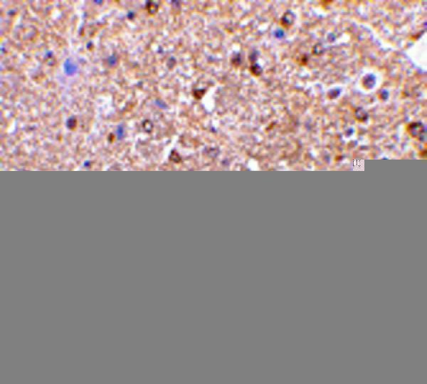 a01844 rtn4 primary antibodies ihc testing 2