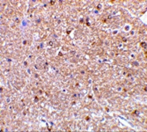 a01844 rtn4 primary antibodies ihc testing 2_1