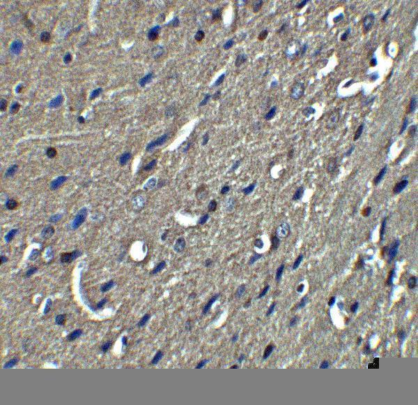 a01844 rtn4 primary antibodies ihc testing 4