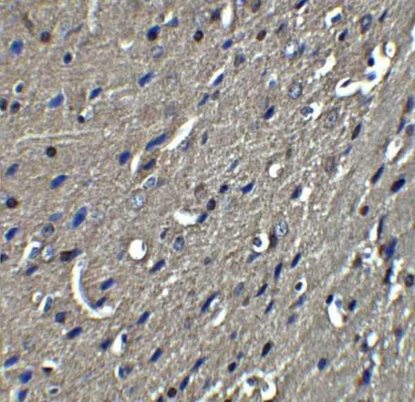 a01844 rtn4 primary antibodies ihc testing 4_1