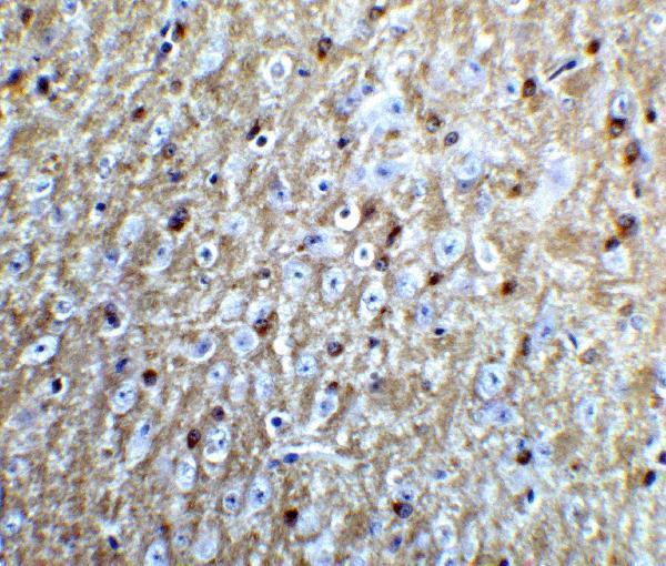 a01844 rtn4 primary antibodies ihc testing 5