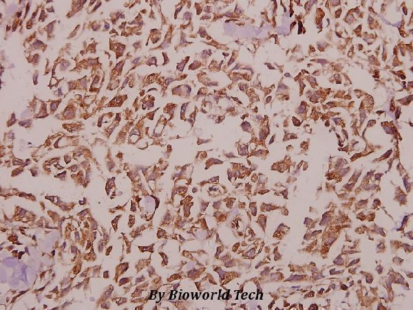 Immunohistochemistry (IHC) analyzes of KIR2