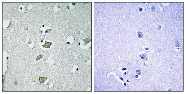 a01850 kcnj2 primary antibodies ihc testing 1